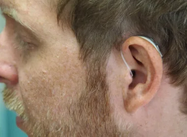 Czy kolczyki przeszkadzają w przeprowadzeniu operacji plastycznej uszu?
